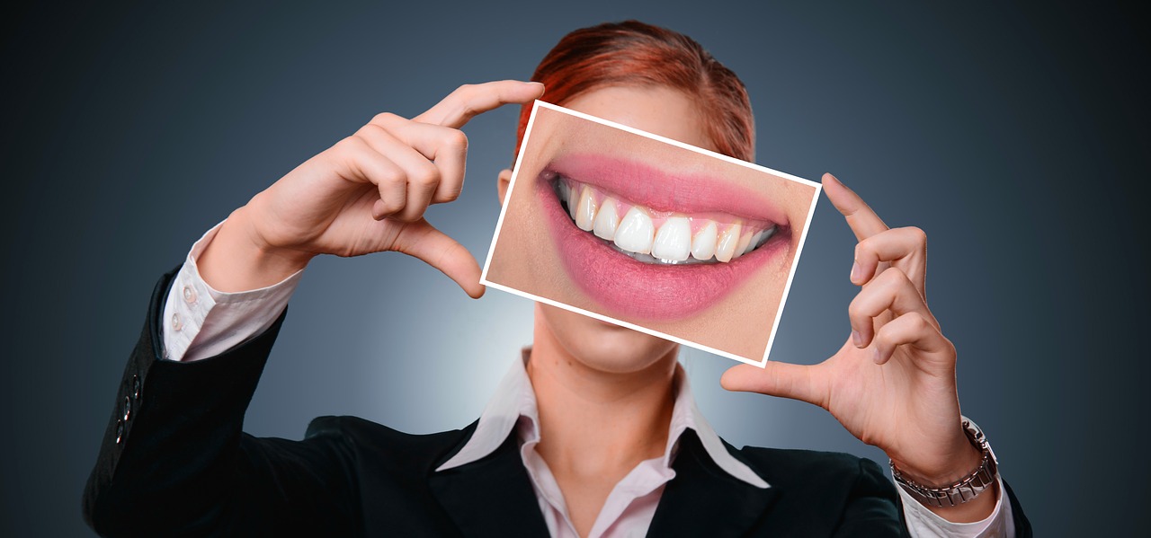 white teeth