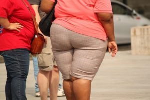 an obese woman